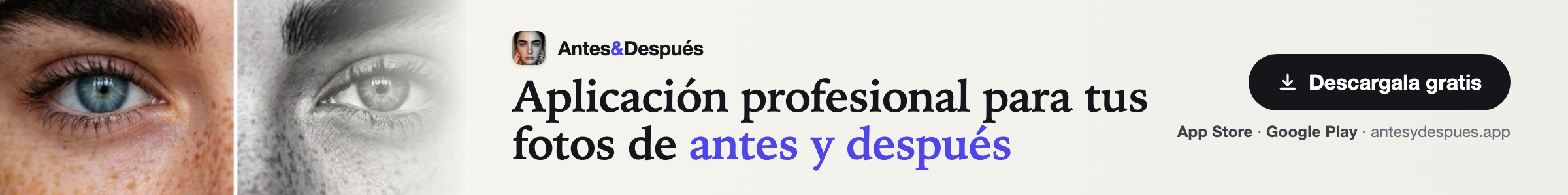 Antes & Después